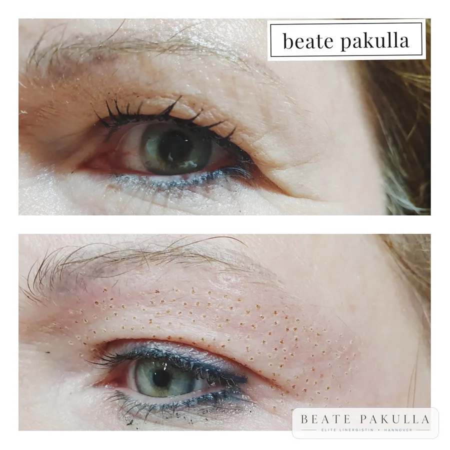 Augenbrauen oder Lidstrich Permanent Make-up bei LTL Elite in Hannover – Beispiel 12