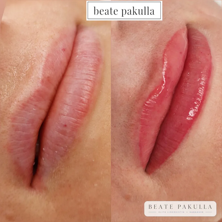 Lippenpigmentierung bei LTL Elite in Hannover – Beispiel 1