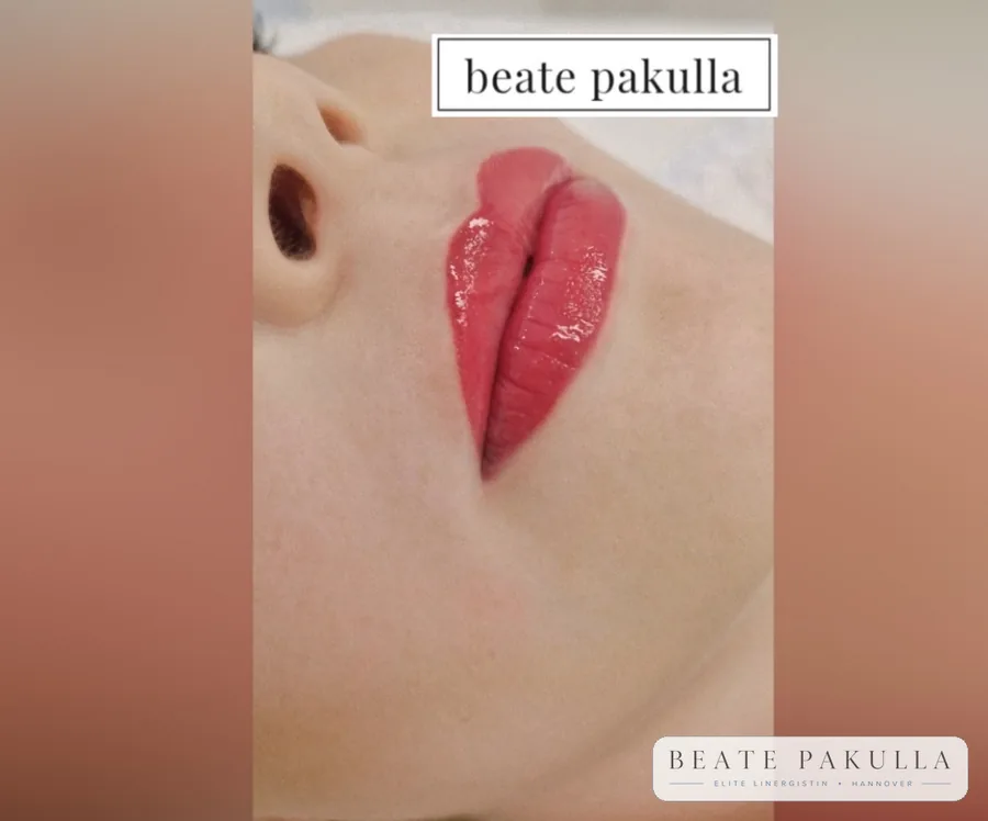 Lippenpigmentierung bei LTL Elite in Hannover – Beispiel 3