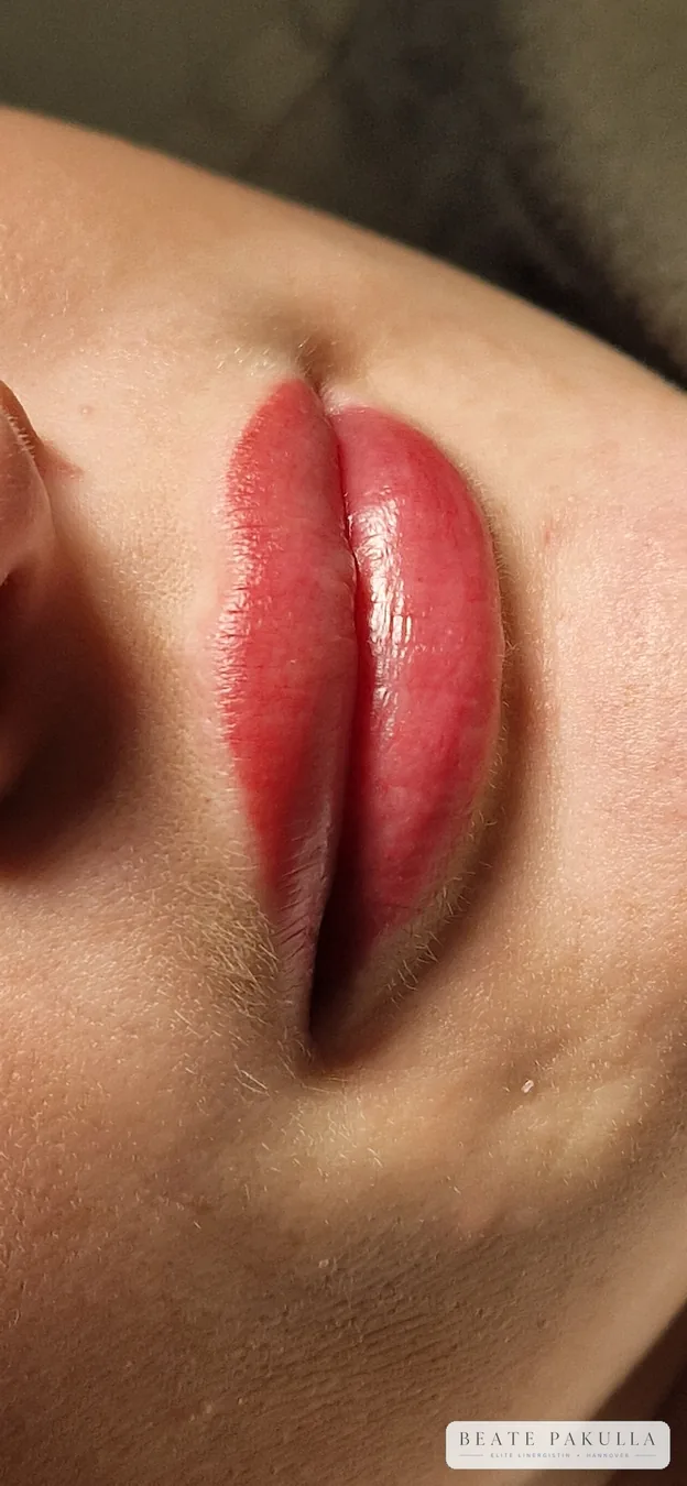 Lippenpigmentierung bei LTL Elite in Hannover – Beispiel 4