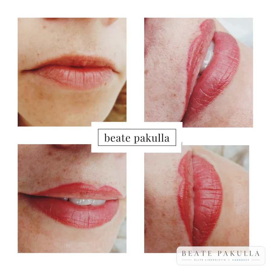 Lippenpigmentierung bei LTL Elite in Hannover – Beispiel 6