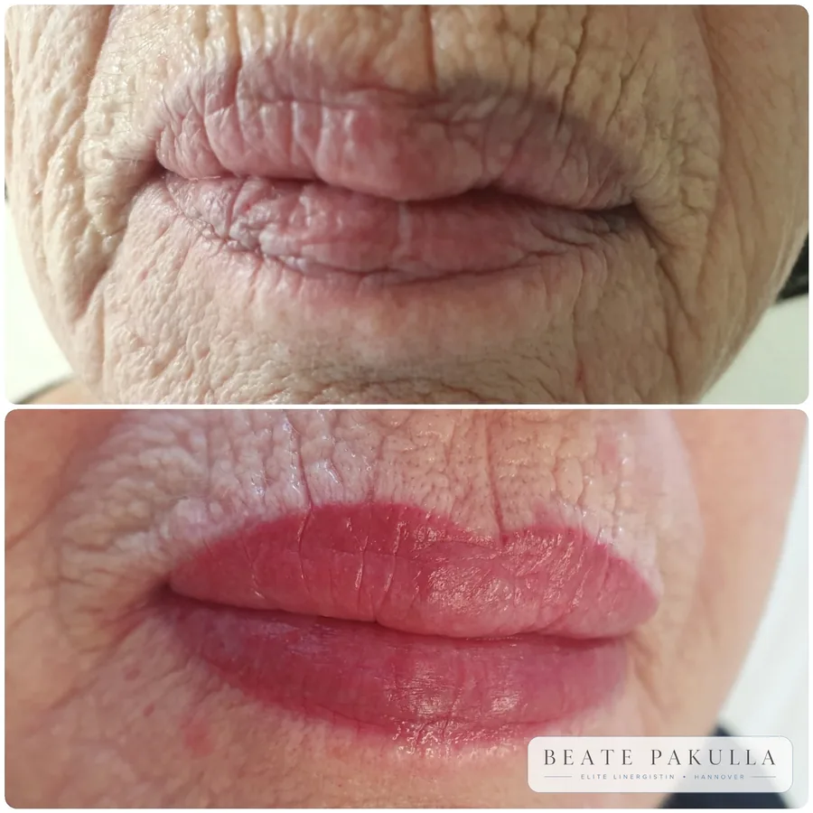 Lippenpigmentierung bei LTL Elite in Hannover – Beispiel 7