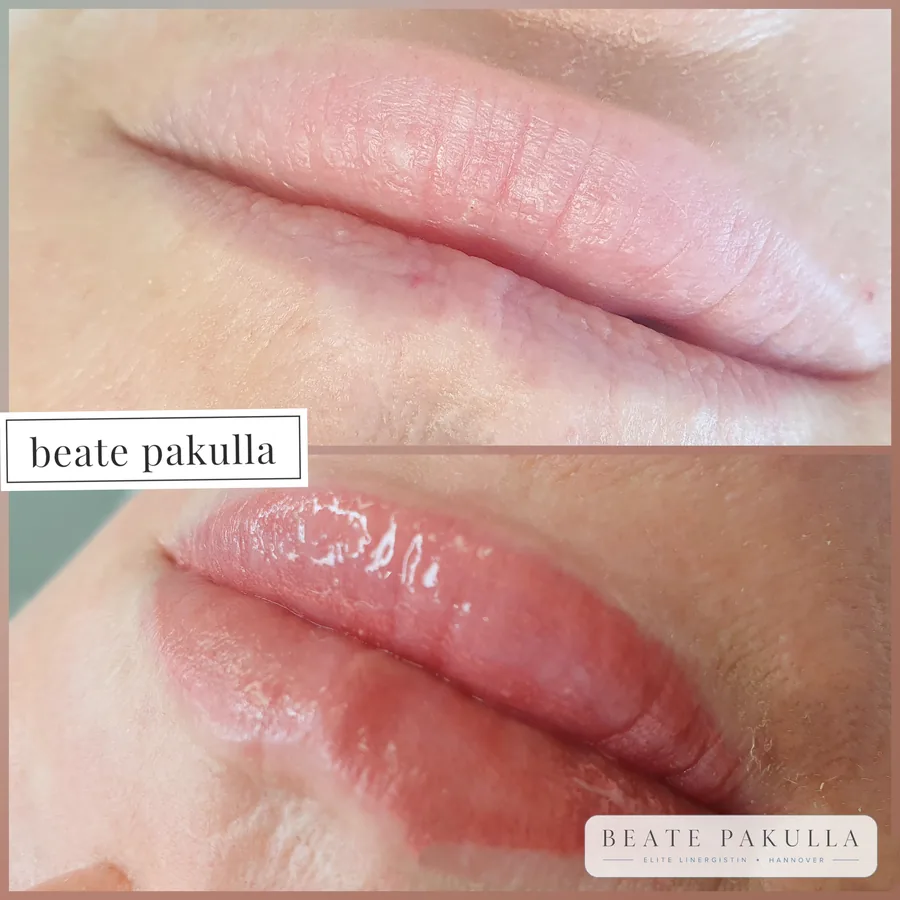 Lippenpigmentierung bei LTL Elite in Hannover – Beispiel 8