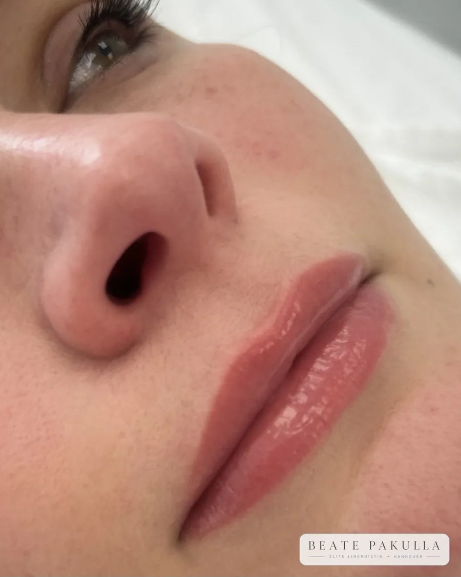 Lippenpigmentierung bei LTL Elite in Hannover – Beispiel 9