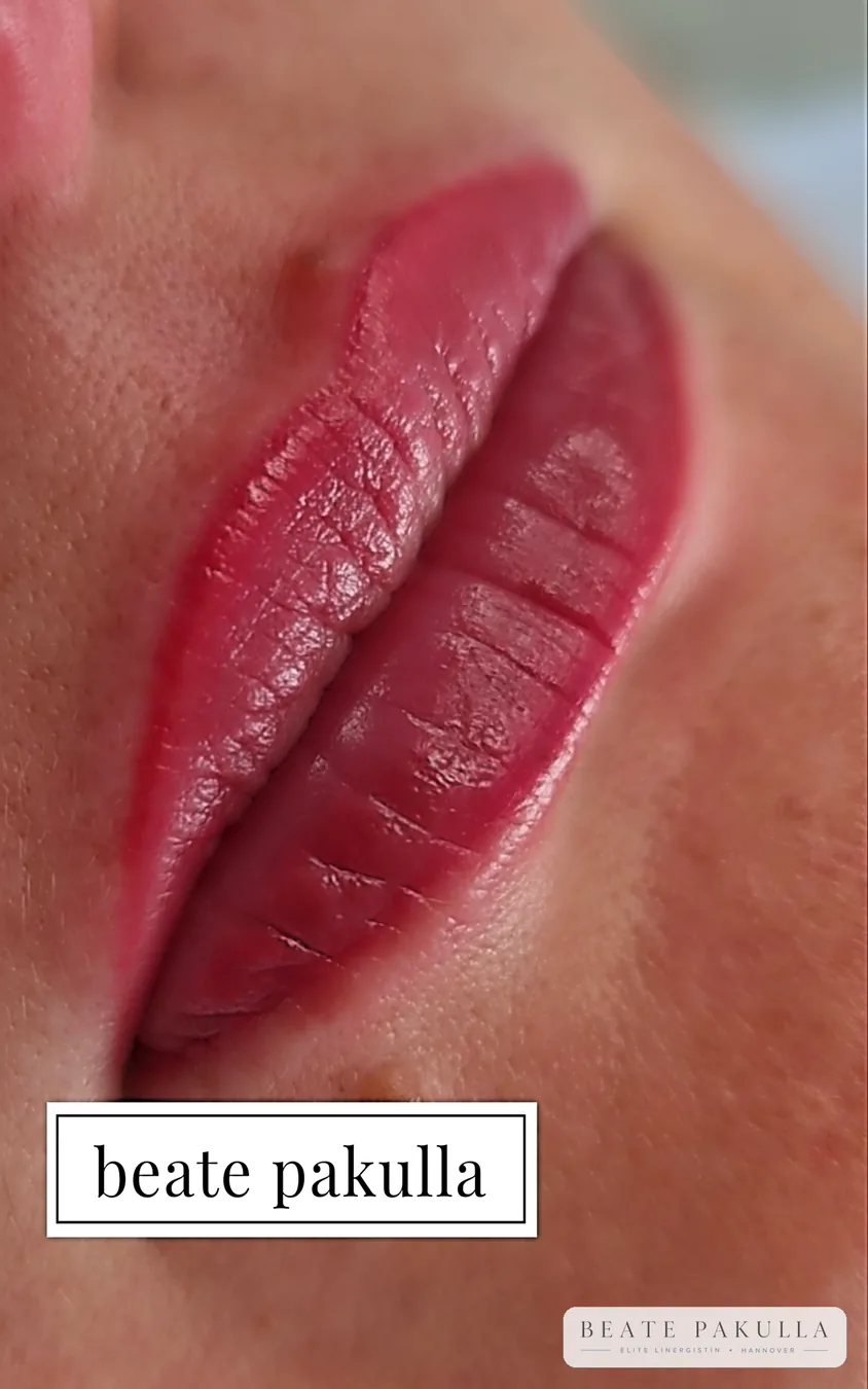 Lippenpigmentierung bei LTL Elite in Hannover – Beispiel 10