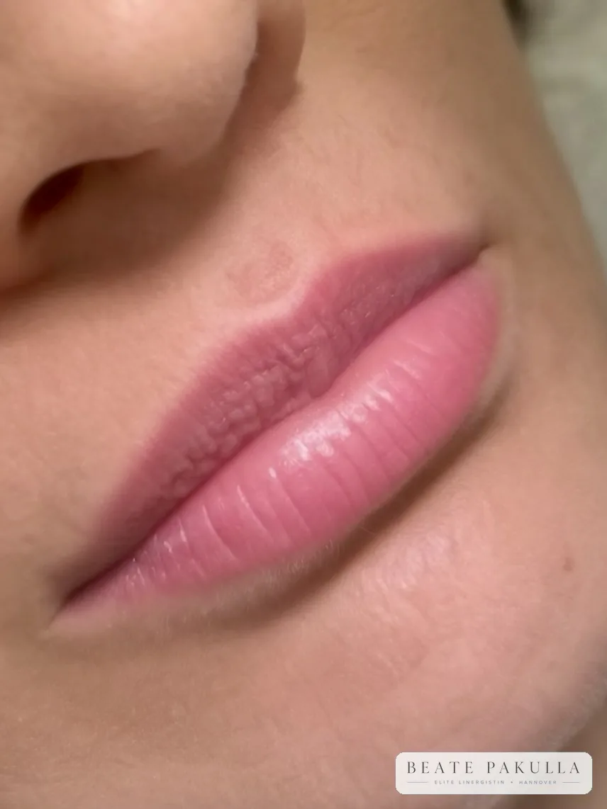 Lippenpigmentierung bei LTL Elite in Hannover – Beispiel 11
