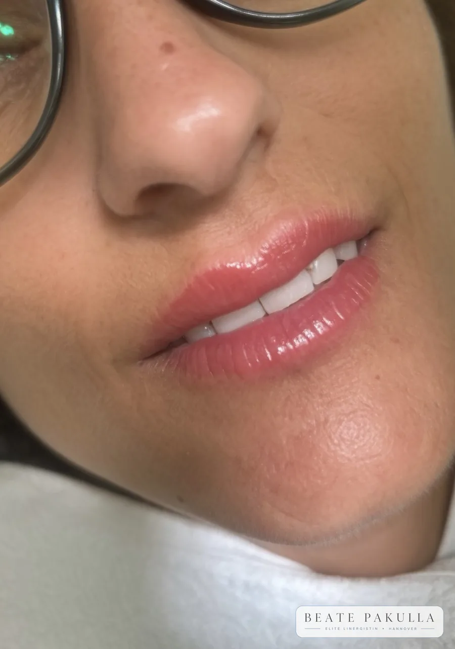 Lippenpigmentierung bei LTL Elite in Hannover – Beispiel 12