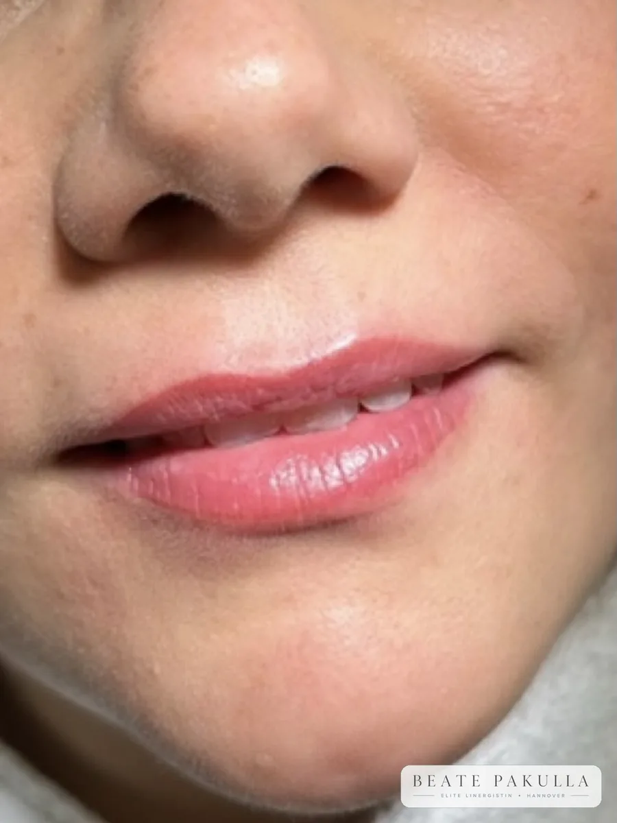 Lippenpigmentierung bei LTL Elite in Hannover – Beispiel 15