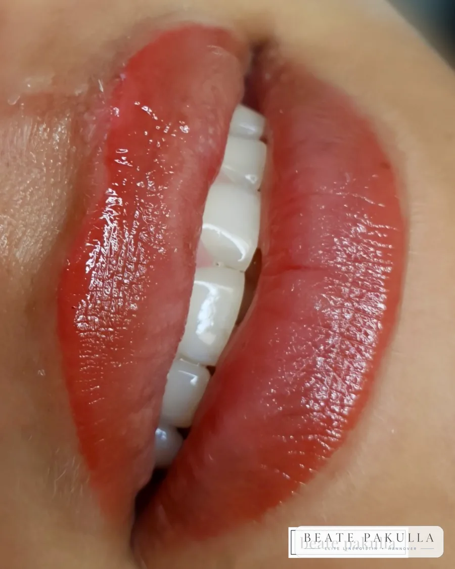 Lippenpigmentierung bei LTL Elite in Hannover – Beispiel 16