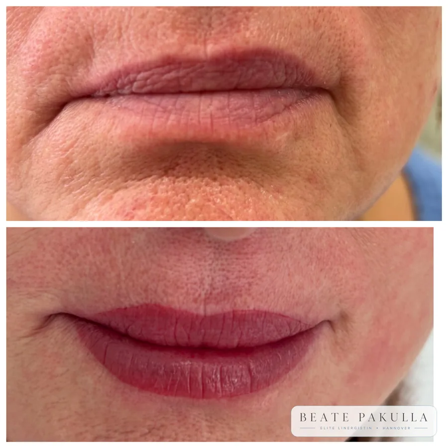Lippenpigmentierung bei LTL Elite in Hannover – Beispiel 17